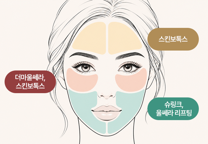 레이어링 시술 부위 안내