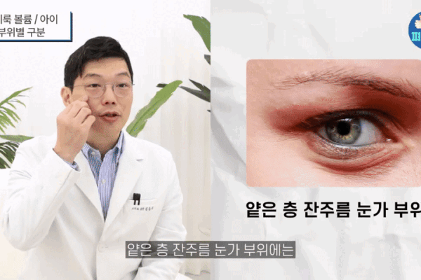 눈밑꺼짐 쥬베룩아이, 뭉침 걱정? '이것' 때문에 안전합니다