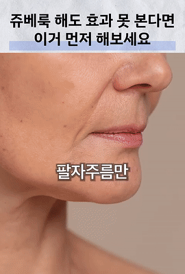 쥬비덤 필러와 쥬베룩, 내 피부에 맞는 선택은 따로 있습니다