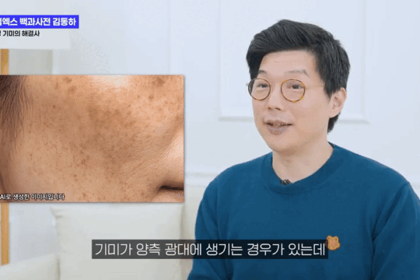 실펌엑스 기미 고주파 레이저,  기미 뿌리부터 해결하는 방법은?