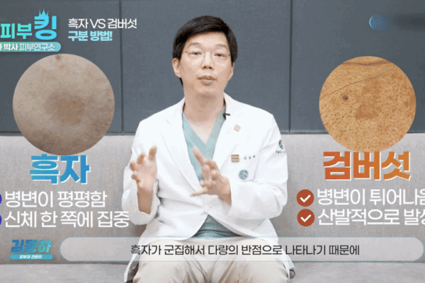 기미 흑자 차이, 신사피부과전문의가 말하는 정확한 OO의 중요성?