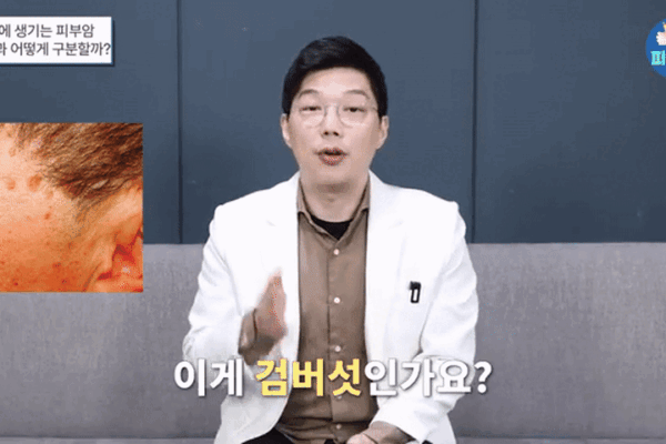 신사피부과 피부암 종류 조기진단?  검버섯과 구별하는 '4가지' 핵심 신호