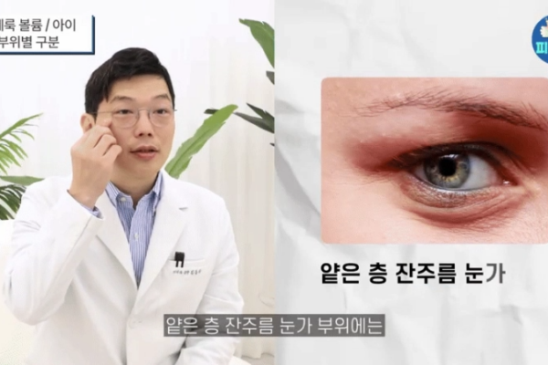 신사역피부과 쥬베룩아이 결절? 눈밑 꺼짐 눈가 전용 콜라겐 부스터로 안전하게 개선하는 방법