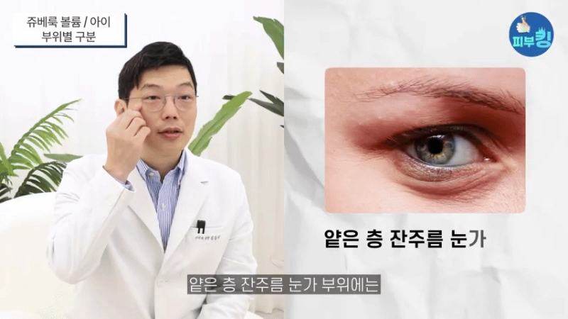 신사역피부과 쥬베룩아이 결절? 눈밑 꺼짐 눈가 전용 콜라겐 부스터로 안전하게 개선하는 방법