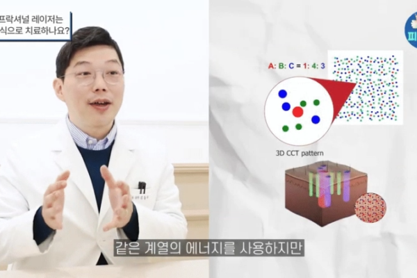 모자이크3D 흉터치료?  기존 프락셔널 레이저의 단점을 극복한 '이것'