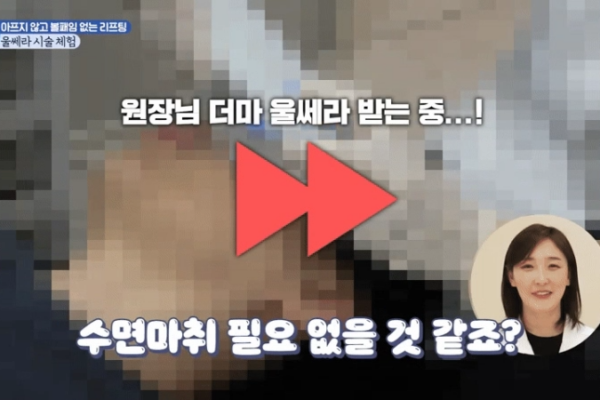 더마울쎄라 세르프 리프팅,  얇은 피부도 안전한 이유가 있습니다
