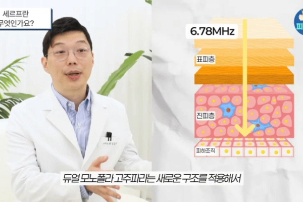 세르프리프팅 효과 통증, 울쎄라·써마지  단점 보완한 '이것' 확인하세요