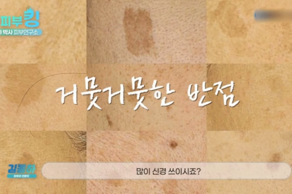 흑자치료 후 관리?  재발 방지 위해 반드시 알아야 할 핵심 사항 4가지